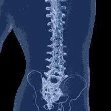 Back pain and Feldenkrais